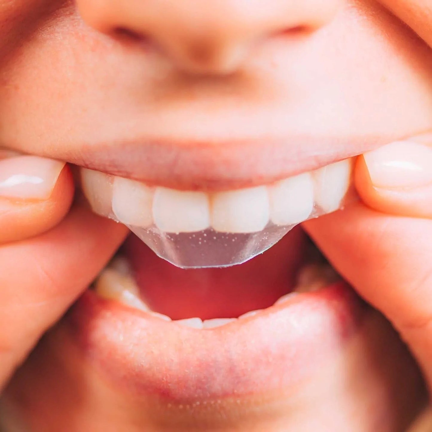 Lot de 2 boîtes patch blanchiment dentaire